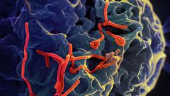 Разработка вакцины против Эболы близка к завершению, заявила Голодец